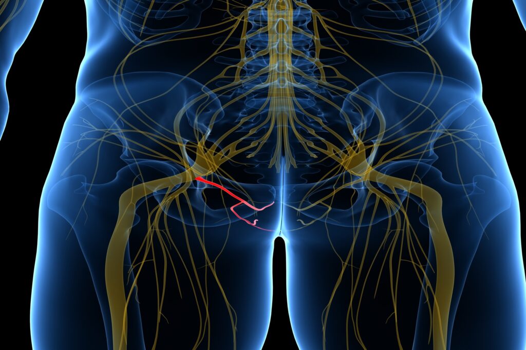 Pudendal Neuralgia​